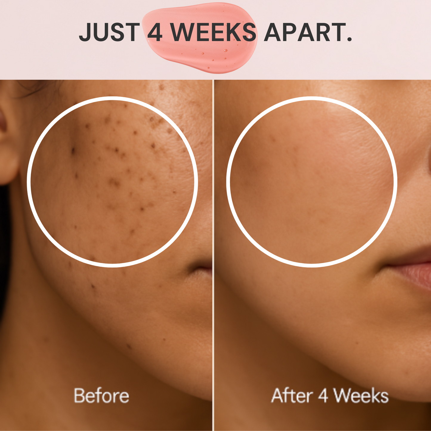 Dark Spot Fix™